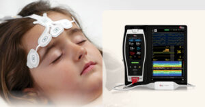 Masimo recibe autorización 510(k) de la FDA para el Pediatric Patient State Index de SedLine